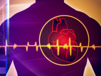 Что такое атеросклеротический кардиосклероз?