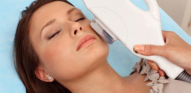 Удаление лазером сосудистых звездочек на лице: преимущества, противопоказания, подготовка к процедуре, восстановление и побочные эффекты